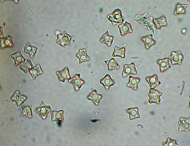 La  Flora  micologica  Alsaziana